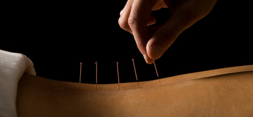 Cum functioneaza acupunctura?